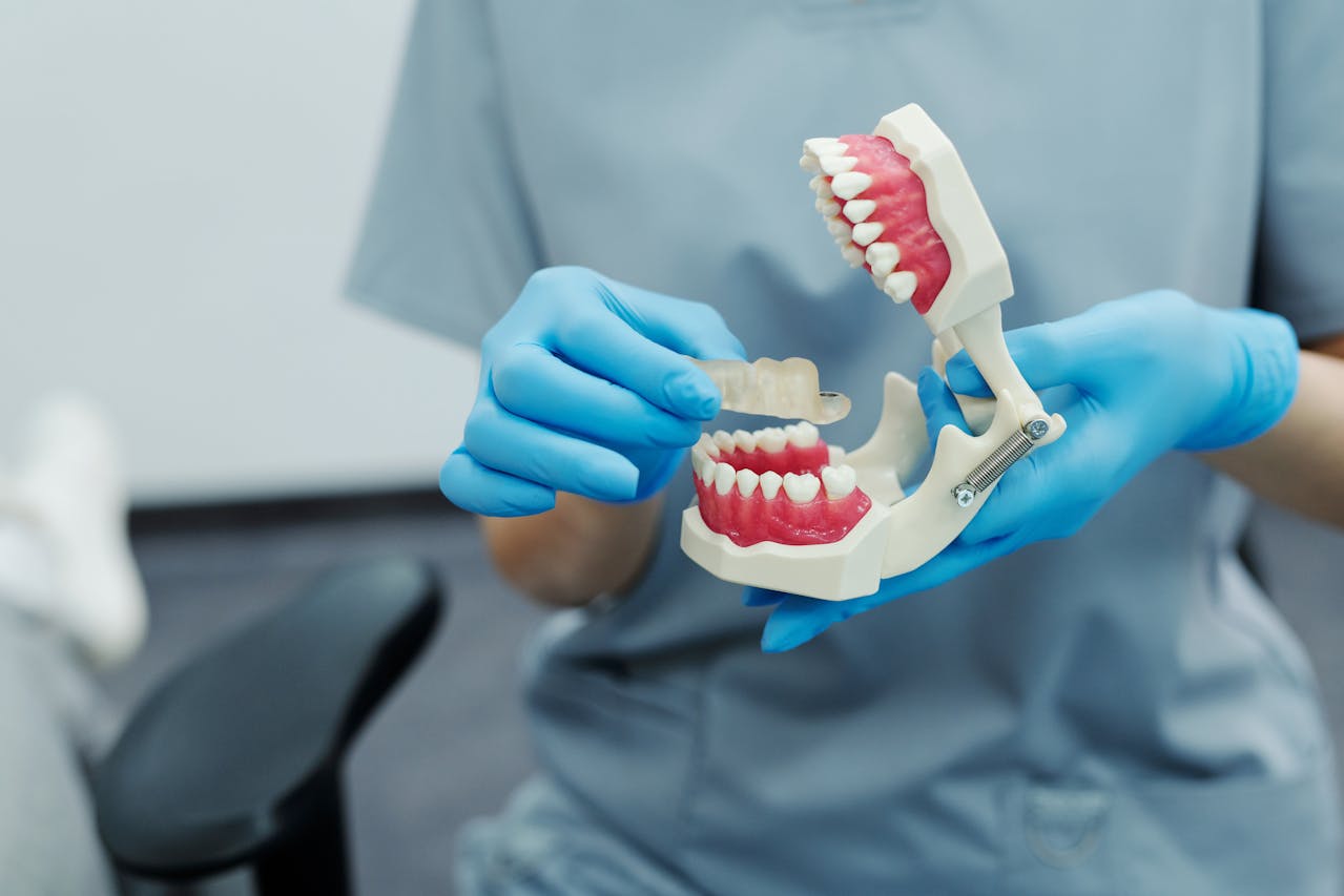 Why You Should Consider Dental Implants